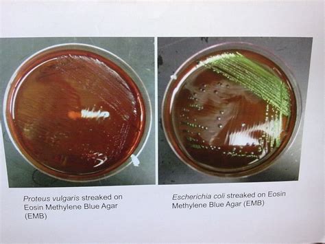 Microbiology, Microbiology lab, Gram negative bacteria