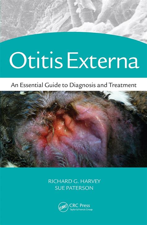 Otitis Externa - An Essential Guide to Diagnosis and Treatment PDF