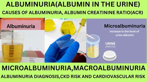 CAUSES SYMPTOMS AND GRADES OF ALBUMINURIA.MICROALBUMINURIA ...