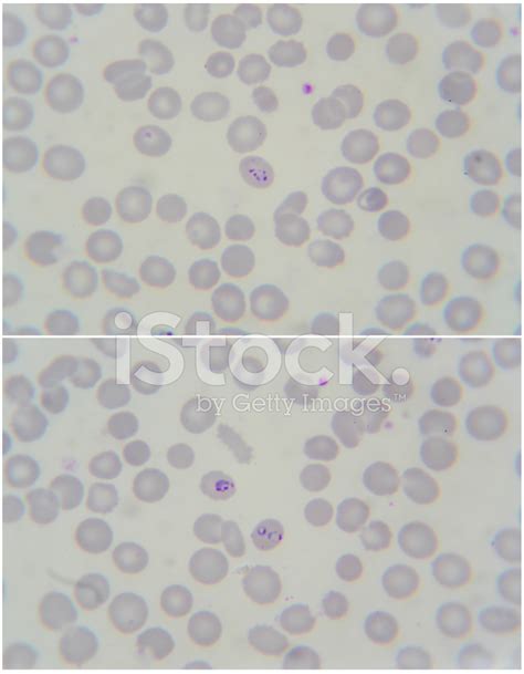 Malaria Parasite Under Microscope 1000x Stock Photo | Royalty-Free | FreeImages