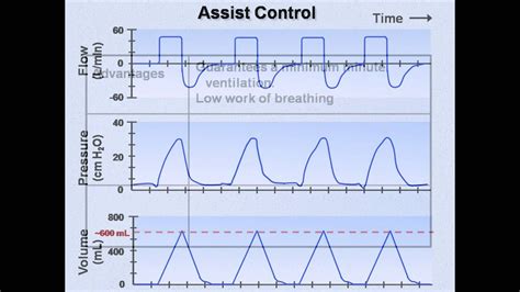 Ventilator Modes (Mechanical Ventilation - Lecture 7) - YouTube