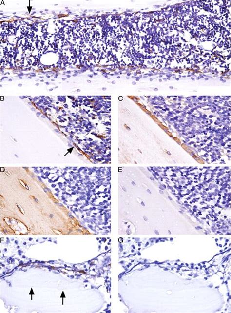 Osteal Tissue Macrophages Are Intercalated throughout Human and Mouse Bone Lining Tissues and ...