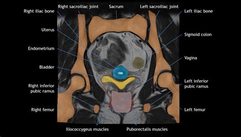 Pelvis Anatomy Module | CaseStacks.com