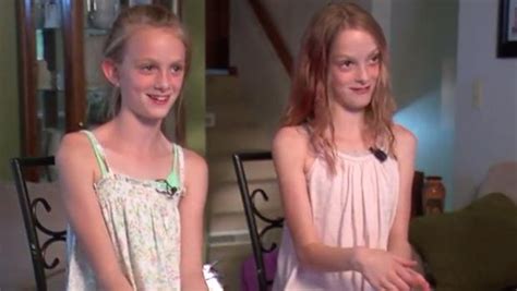 North Dakota conjoined twins celebrate 10 years apart - CBS News