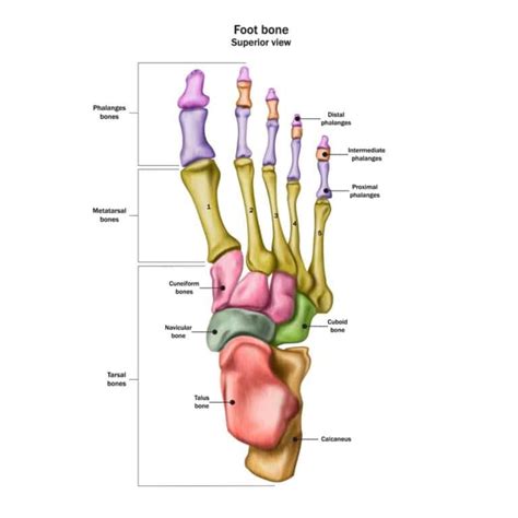 Foot Fracture Surgery - Pediatric Foot & Ankle