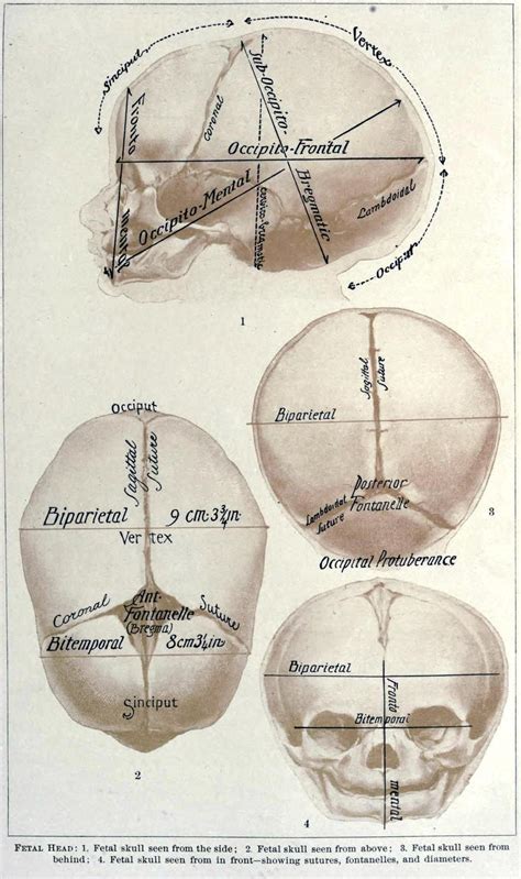 Fetal head - displaying bones, fontanelles, and... - Biomedical Ephemera, or: A Frog for Your Boils