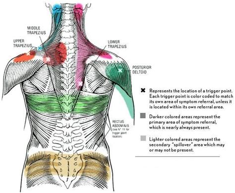 Massage Trigger Points | Trigger points, Trigger point therapy, Trigger point massage