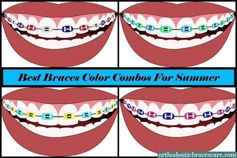 31 Unique Braces Colors And Combinations For Summer - Orthodontic ...