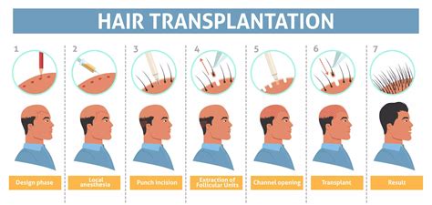 Hair Transplant Treatment | Booking Surgery