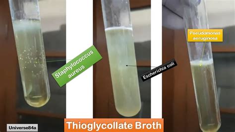 E coli , Staphylococcus aureus and Pseudomonas aeruginosa growth on ...