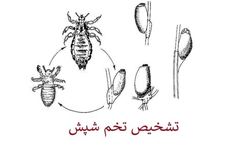 علت ایجاد شپش چیست ؟ شپش از چی به وجود میاد؟ | فروشگاه خرید سم بیا تو کالا