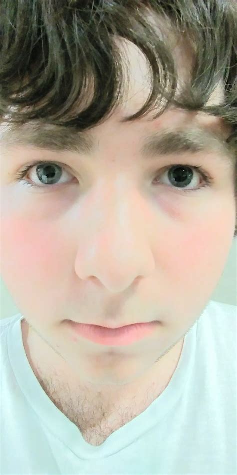 Different sized pupils/Anisocoria : r/migraine