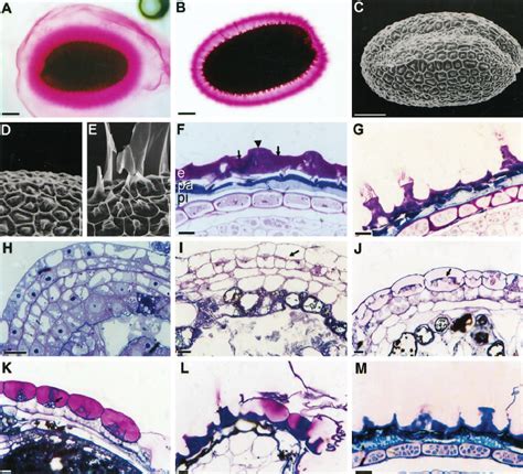 Structure and development of the wild-type seed coat. A and B, Stained ...