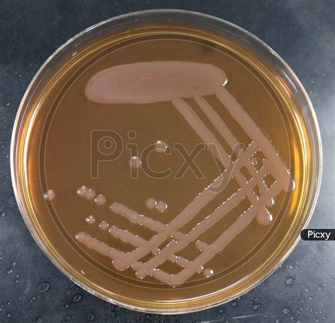 Image of MacConkey agar with lactose fermenting and non lactose fermenting colonies-RZ655429-Picxy