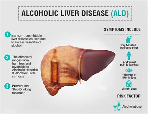 Alcoholic And, Nonalcoholic Fatty Liver Disease!