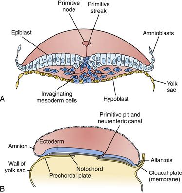 Disorders of Neural Tube Development | Neupsy Key