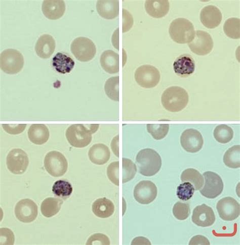 Esquizontes de Plasmodium Malariae