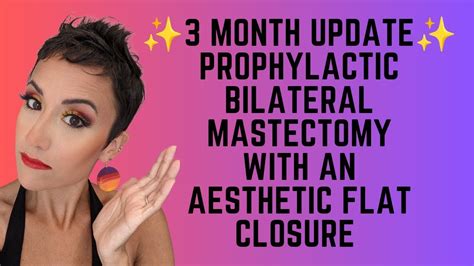 3 Month Update Prophylactic bilateral mastectomy with an aesthetic flat closure - YouTube