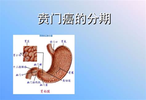 贲门是在胸口位置图片,胃贲门的位置图片 - 伤感说说吧