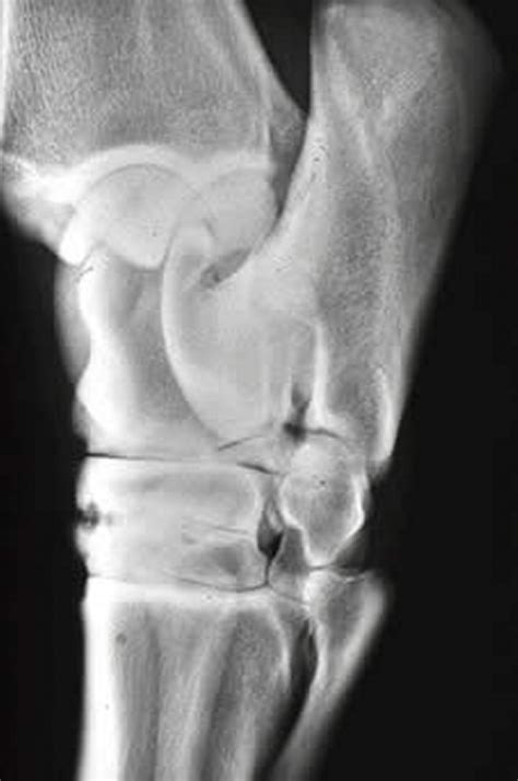 Image: Bone spavin, horse - MSD Veterinary Manual