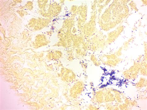 BBS-1 | Gram Stain Kit (Modified Brown & Brenn) Quimigen