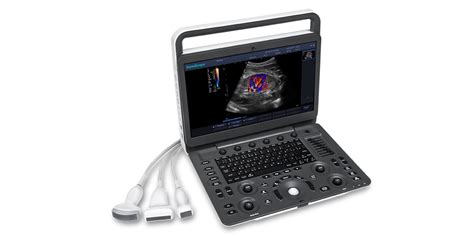 Sonoscape E3 Colour Doppler Ultrasound Machine - Portable Ultrasound Machines