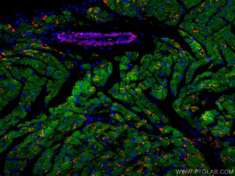 smooth muscle actin specific antibody (CL647-67735) | Proteintech