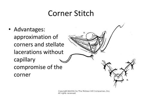 PPT - Suturing Basics PowerPoint Presentation, free download - ID:2156670