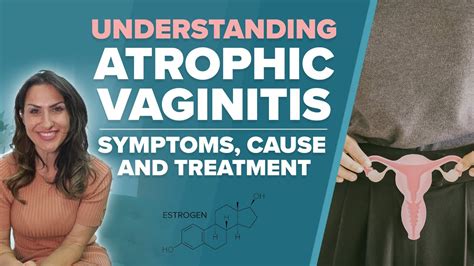 Understanding Atrophic Vaginitis: Symptoms, Causes, and Treatment - YouTube