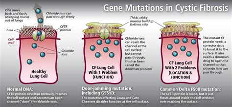 Cystic Fibrosis genetics: Know Your CF Mutations