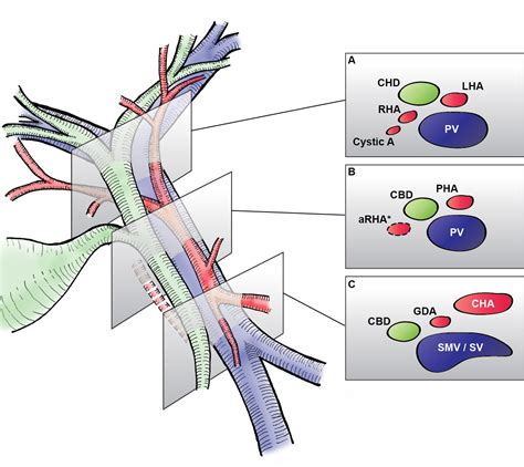 hepatoduodenal ligament – DataSurg