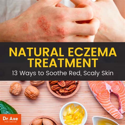 13 Best Natural Eczema Treatment Options - Dr. Axe