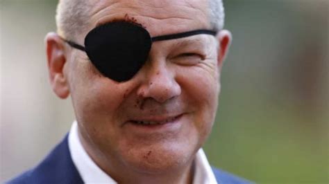 Germany’s Olaf Scholz sports eyepatch post-injury, says 'excited to see the memes' - World News