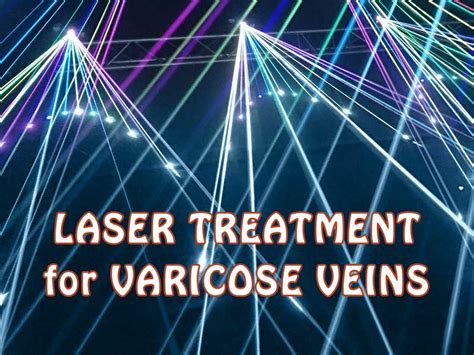 Laser Treatment for Varicose Veins: Remove Them! - Denver Vein Center