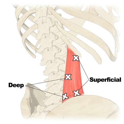 Quadratus Lumborum Muscle Trigger Points