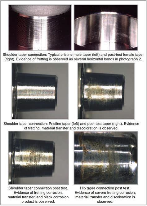 Preventing Fretting Corrosion of Orthopedic Devices | Element