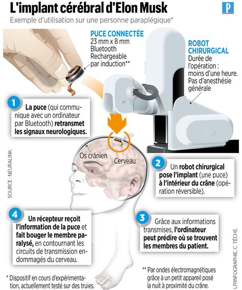 Neuralink, l’implant cérébral d’Elon Musk : ce qu’en pensent les scientifiques - Le Parisien