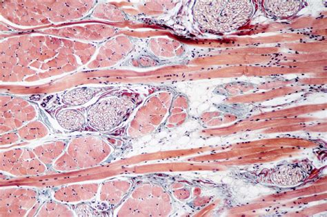 Histology Of Muscle Tissue