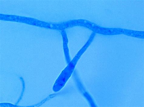 Fun With Microbiology (What's Buggin' You?): Epidermophyton floccosum