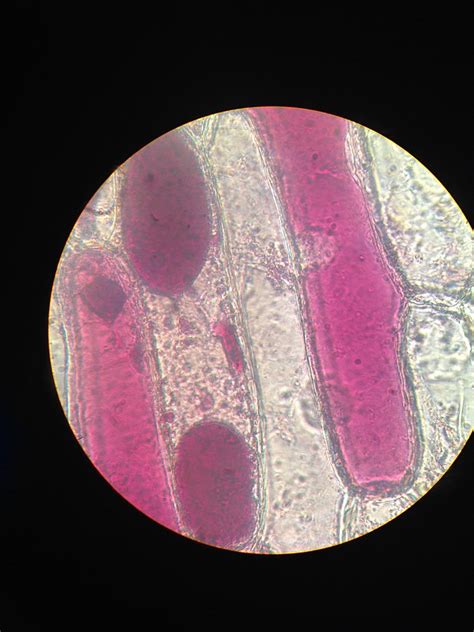 Difference Between Plasmolysis and Hemolysis l Plasmolysis vs Hemolysis