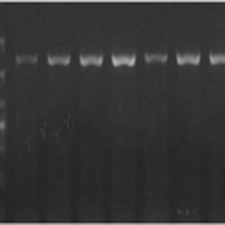 Positive results of APP/PS1 transgenic mice genotype by RT-PCR. The ...