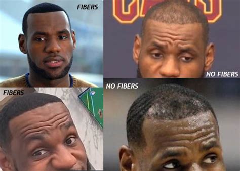 18+ lebron hair plugs - SoniaZahraa