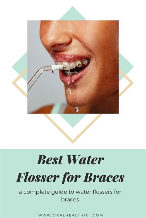 Best Water Flosser for Braces | Water flosser, Flosser, Braces