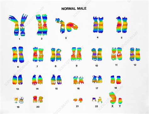 Normal Male Karyotype - Stock Image - C022/0567 - Science Photo Library