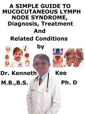 A Simple Guide to Mucocutaneous Lymph Node Syndrome (Kawasaki Disease), Diagnosis, Treatment and ...