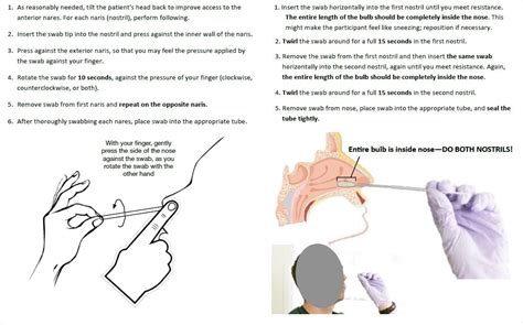 Nasal swab tests miss low viral SARS-CoV-2