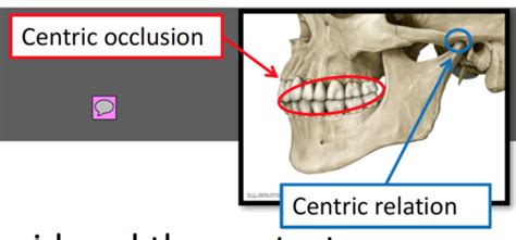 occlusion seminar Flashcards | Quizlet