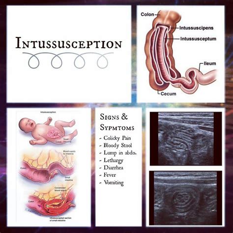 Pin by Lauri Grahn on Sonography Images | Pediatric nursing, Medical ...