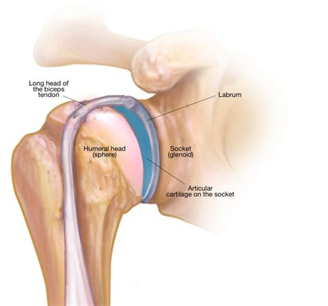 My Shoulder Superior Labrum is Torn: Do I Need Surgery? - Shoulder & Elbow