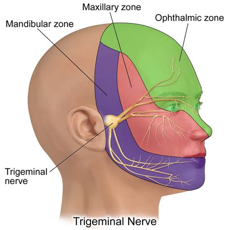 Trigeminal Neuralgia - Physiopedia